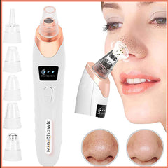 5-in-1 Blackhead remover, blackhead remover machine, derma suction, pimple acne remover, blackhead vacuum machine, dust remover.